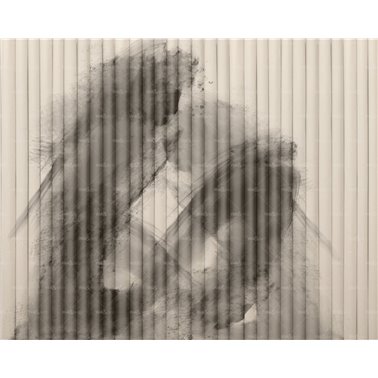 Macula WET_MA2402
