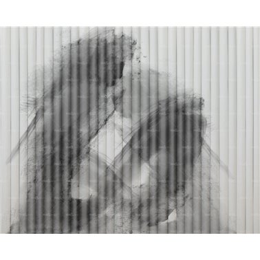 Macula WET_MA2401
