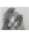 Macula WET_MA2401